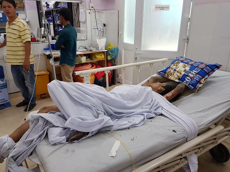 loi khai cua co gai bi nguoi yeu khoa trai trong phong tro, cham lua dot quan ao - 1