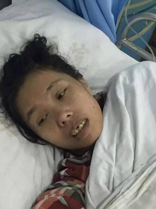 co dau bong nhien bat day tu quan tai khien ca lang so hai bo chay - 1