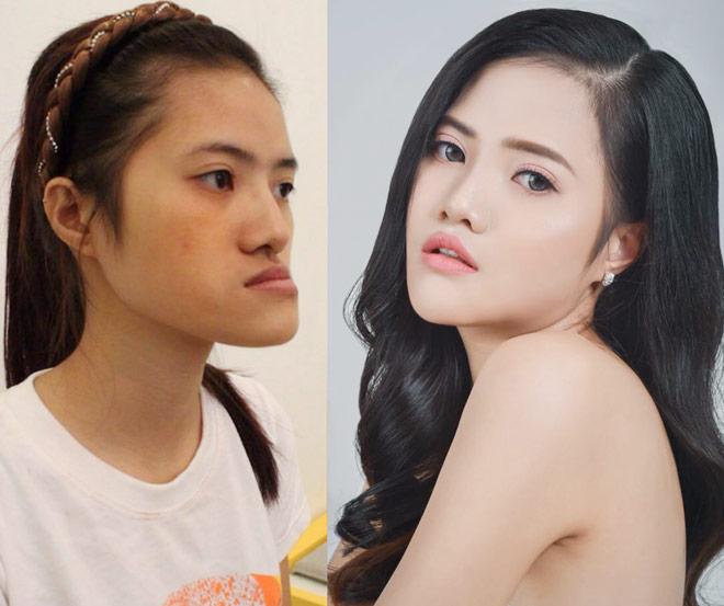 nhung co gai, chang trai viet "lot xac" nho tham my co so sinh con nhu ban goc? - 4