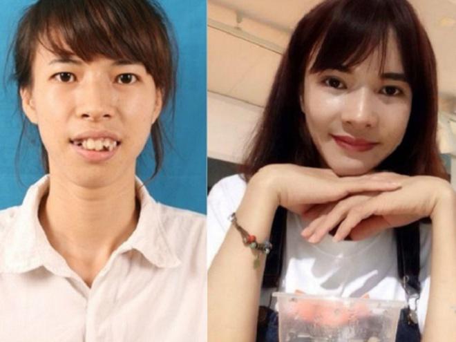 nhung co gai, chang trai viet "lot xac" nho tham my co so sinh con nhu ban goc? - 5