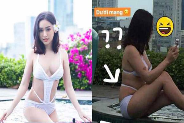 sau hut 2 kg mo bung, thuy vi khang dinh se khong bao gio "dao keo" nua - 1