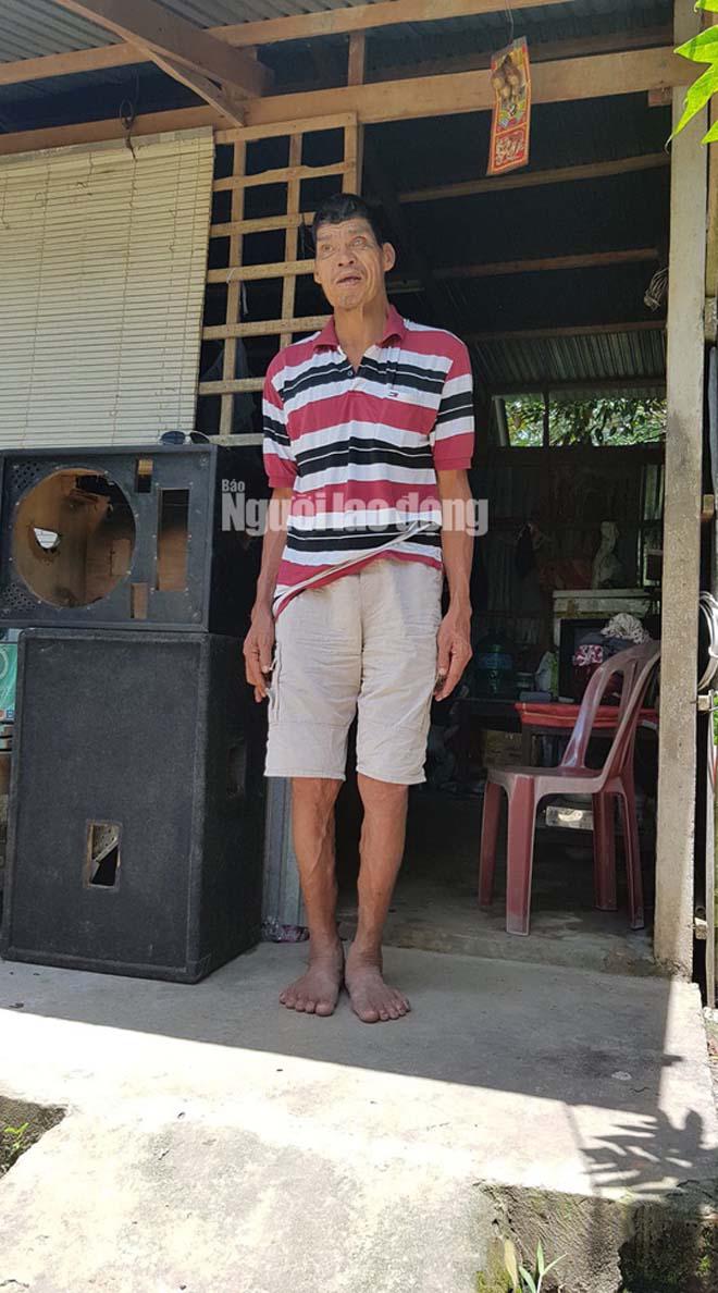 cuoc song kho khan cua nguoi "khong lo" cao hon 2,1 m o mien tay - 2