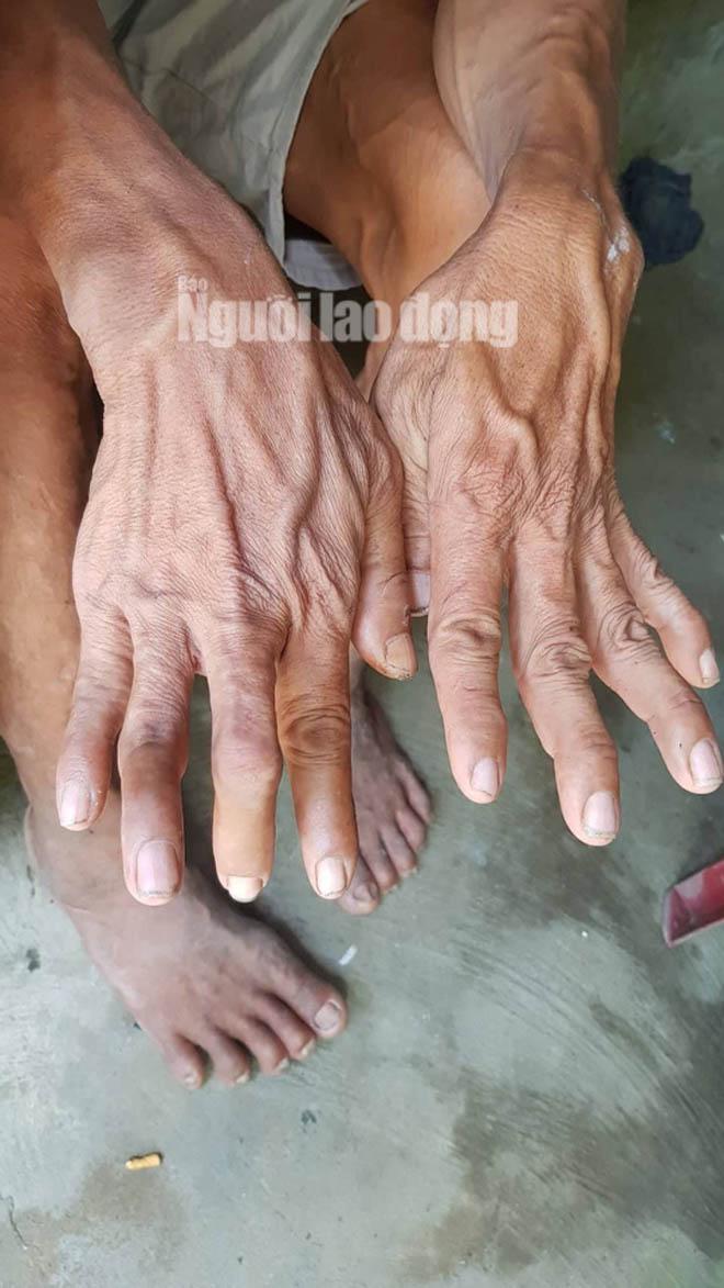 cuoc song kho khan cua nguoi "khong lo" cao hon 2,1 m o mien tay - 3