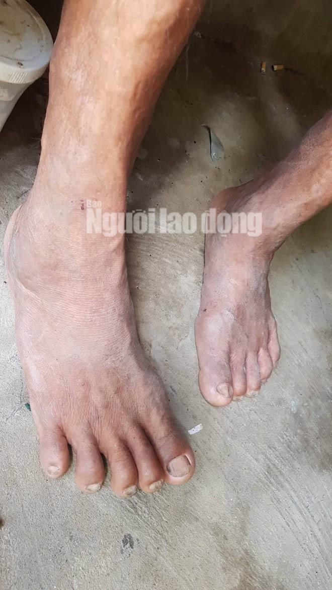 cuoc song kho khan cua nguoi "khong lo" cao hon 2,1 m o mien tay - 4