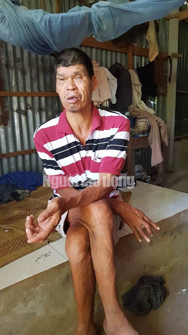 cuoc song kho khan cua nguoi "khong lo" cao hon 2,1 m o mien tay - 8