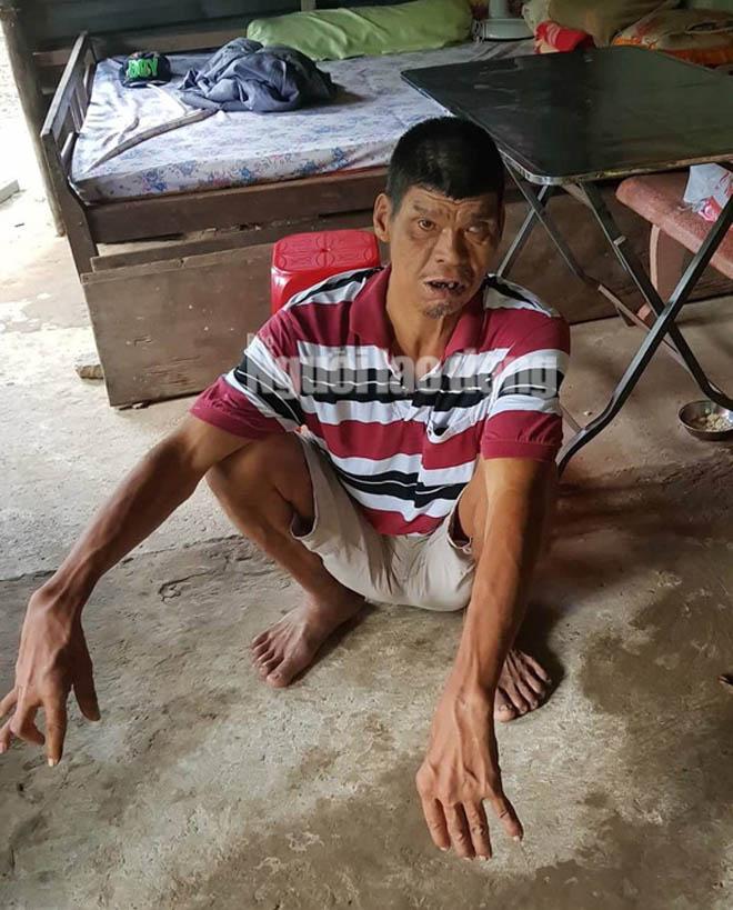 cuoc song kho khan cua nguoi "khong lo" cao hon 2,1 m o mien tay - 9