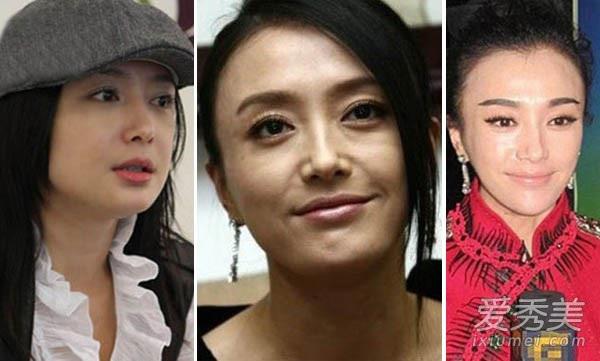 qua xinh dep, cac my nhan phim dien hy cong luoc bi "boc phot" phau thuat tham my? - 15