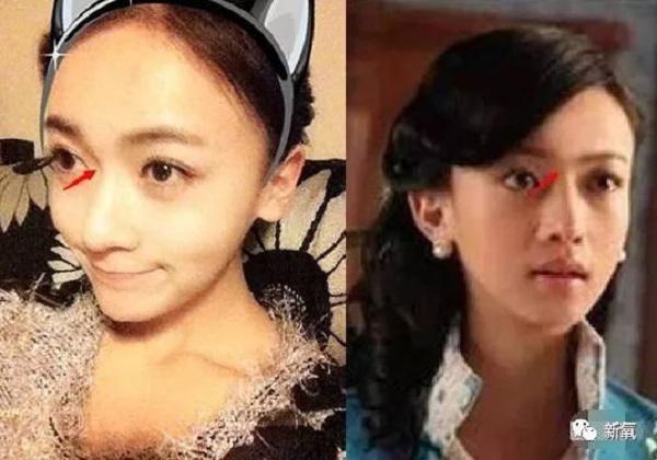 qua xinh dep, cac my nhan phim dien hy cong luoc bi "boc phot" phau thuat tham my? - 3