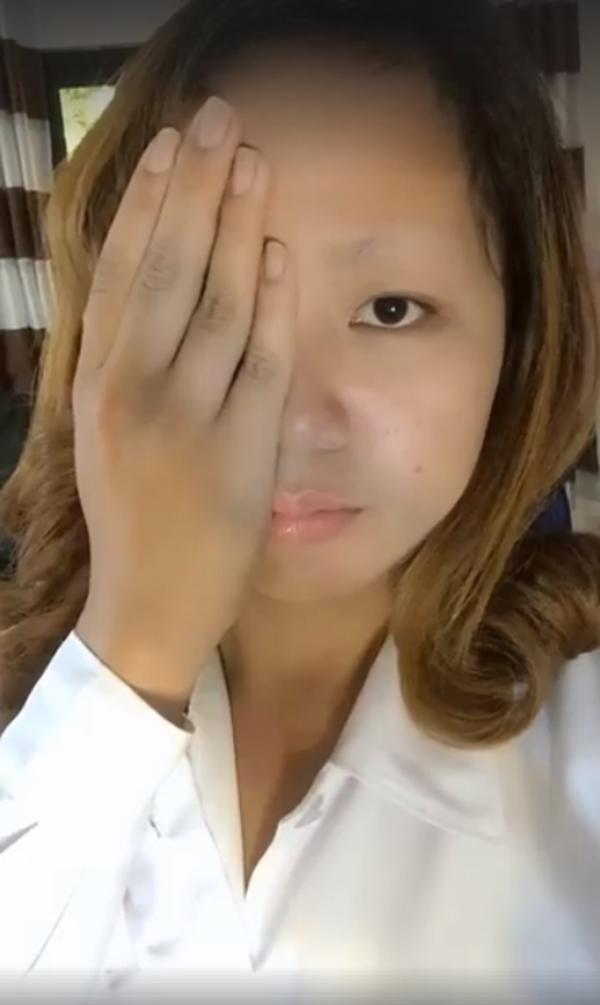 lot mun dau den sai cach, co gai "khoc rong" vi di luon doi long may duong 20 nam - 5