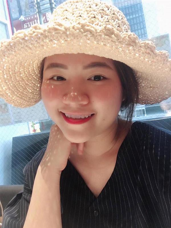 nho dieu nay, khong ai tin duoc lan da cua co nang da tung bi “tan pha” boi kem tron! - 2