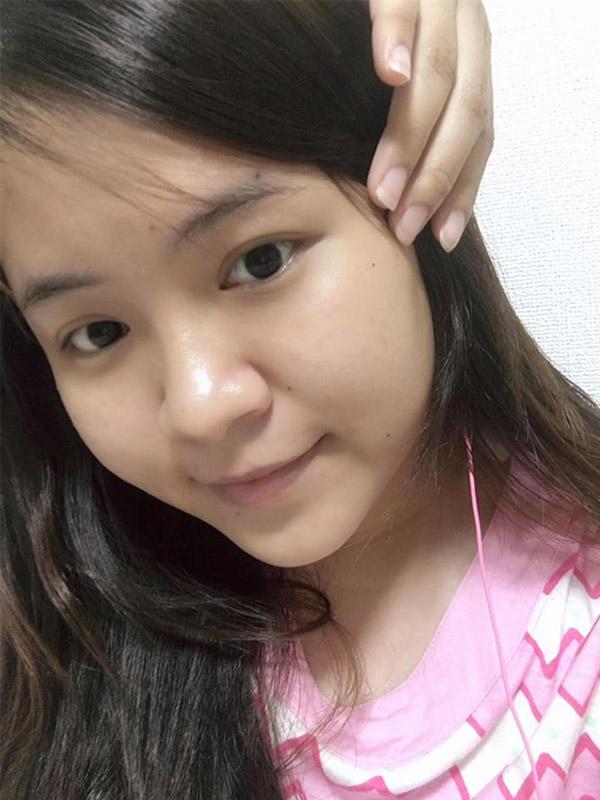 nho dieu nay, khong ai tin duoc lan da cua co nang da tung bi “tan pha” boi kem tron! - 3