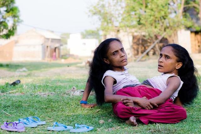 chuyen tinh ky la cua cap chi em song sinh dinh lien than cung yeu mot chang trai - 2