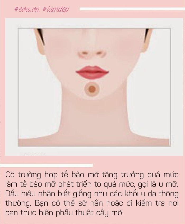 cay mo o bung roi tiem len mat, da duoc tre hoa vinh vien, thuc hu ra sao? - 6