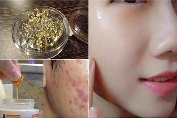 dung mat na vitamin e, co ngay lan da trang boc nhu trung chi sau 2 ngay! - 4
