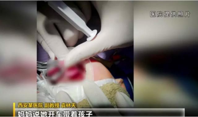 de con ngoi choi o ghe sau o to, me bat ngo danh lai khien con nga dut luoi - 2