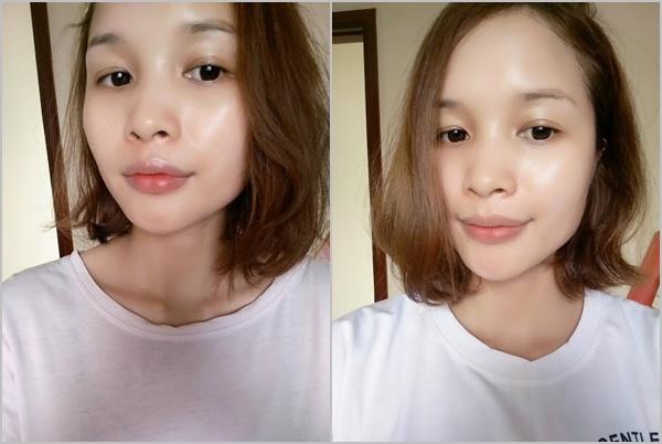 chieu long ban trai dung kem tron, co gai nay da mat 2 nam de phuc hoi da cua minh - 7