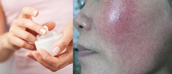 chieu long ban trai dung kem tron, co gai nay da mat 2 nam de phuc hoi da cua minh - 10