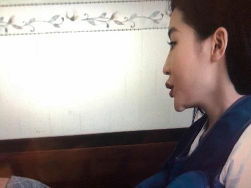 luon khang dinh dep nho bam huyet, dau vet la o cam ky duyen co noi dieu nguoc lai? - 4