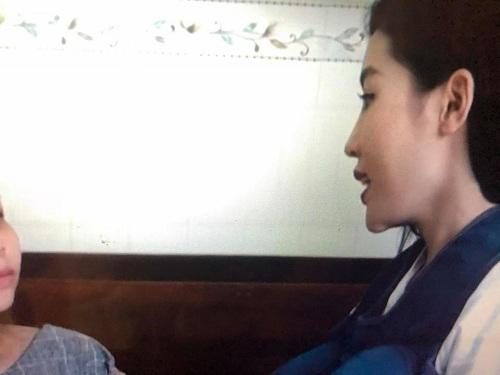 luon khang dinh dep nho bam huyet, dau vet la o cam ky duyen co noi dieu nguoc lai? - 3