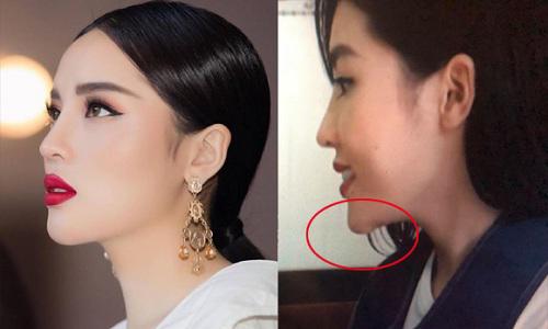 luon khang dinh dep nho bam huyet, dau vet la o cam ky duyen co noi dieu nguoc lai? - 2