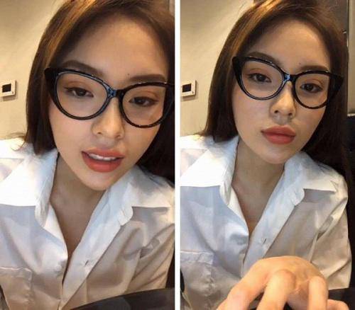 luon khang dinh dep nho bam huyet, dau vet la o cam ky duyen co noi dieu nguoc lai? - 8