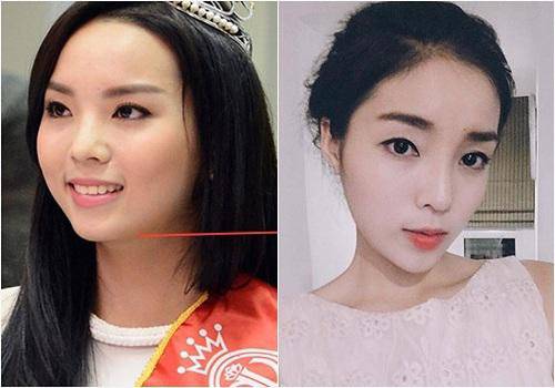 luon khang dinh dep nho bam huyet, dau vet la o cam ky duyen co noi dieu nguoc lai? - 9