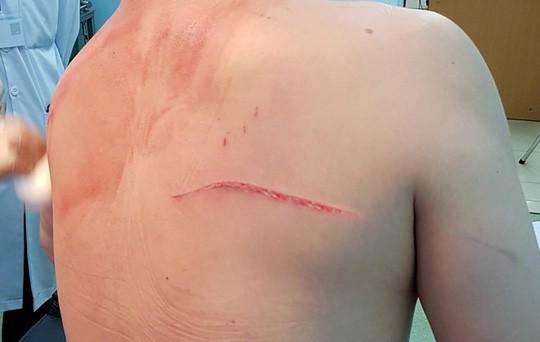 dien bien bat ngo vu ly hon dinh dam cua bac si chiem quoc thai - 3