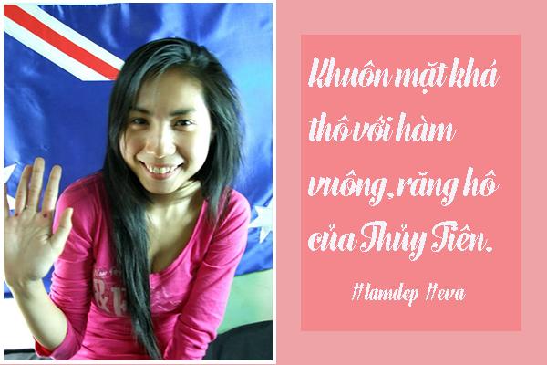 day co phai nhung my nhan viet len doi nhan sac nho chi "bon tien" de phau thuat? - 18