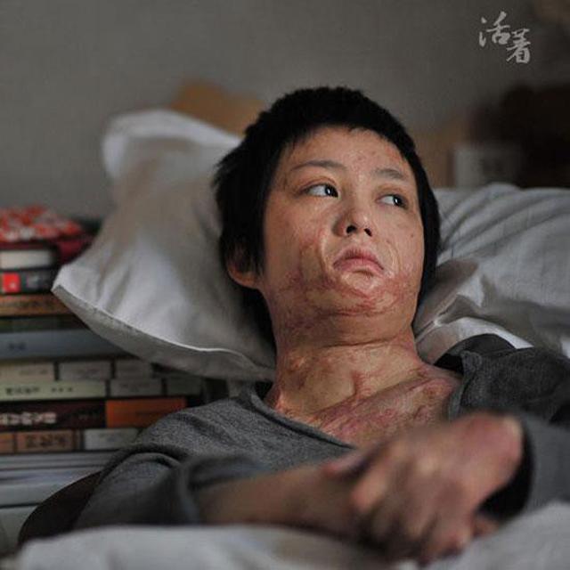 tu choi tinh cam cua thieu gia, thieu nu xinh dep "song khong bang chet" vi bi thieu song - 2
