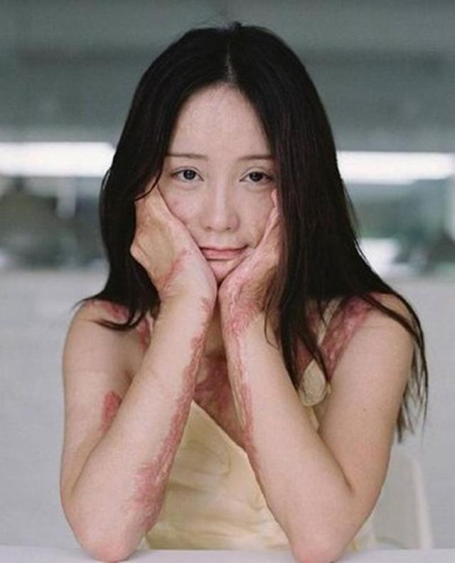 tu choi tinh cam cua thieu gia, thieu nu xinh dep "song khong bang chet" vi bi thieu song - 4