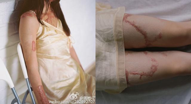 tu choi tinh cam cua thieu gia, thieu nu xinh dep "song khong bang chet" vi bi thieu song - 7