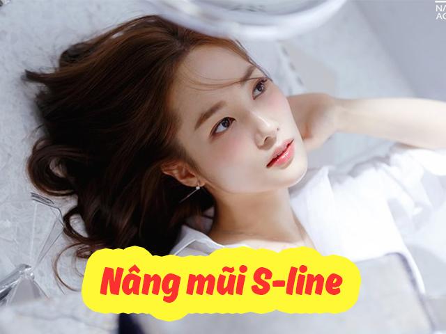 Nâng mũi S-line và những điều bạn cần biết trước khi quyết định bước làm đẹp này