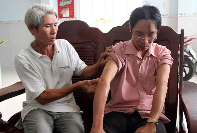 chan dong vu hai me con di cho ban vang bi cuop hon 2,5 ty dong bang hoi cay - 1