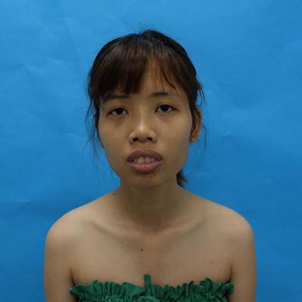bi duoi viec vi qua xau, co nang nay quyet tam "vit hoa thien nga" nho dao keo - 2