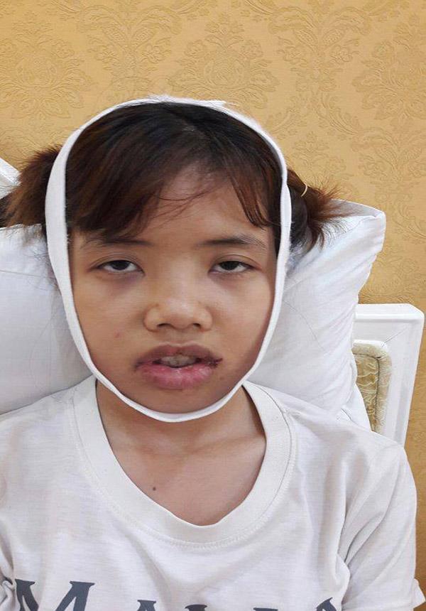 bi duoi viec vi qua xau, co nang nay quyet tam "vit hoa thien nga" nho dao keo - 3