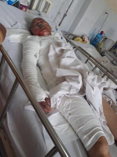 thong tin moi nhat vu chong tam xang thieu song 3 me con o dong nai - 1