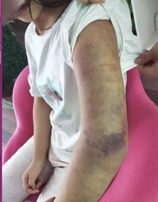 con gai bi me ke danh lan roi kin nguoi, bo ruot chi bao "danh cho la dung" - 3