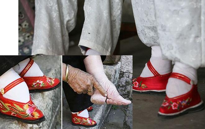 bo chan got sen, keo co dai: lam dep ky quai, dau don the nay ma van co nguoi lam! - 1