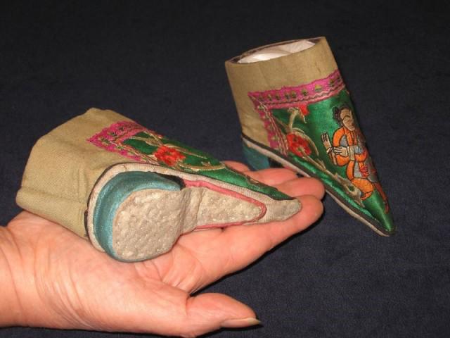 bo chan got sen, keo co dai: lam dep ky quai, dau don the nay ma van co nguoi lam! - 2