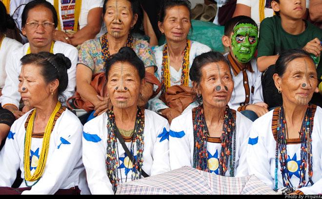 bo chan got sen, keo co dai: lam dep ky quai, dau don the nay ma van co nguoi lam! - 5