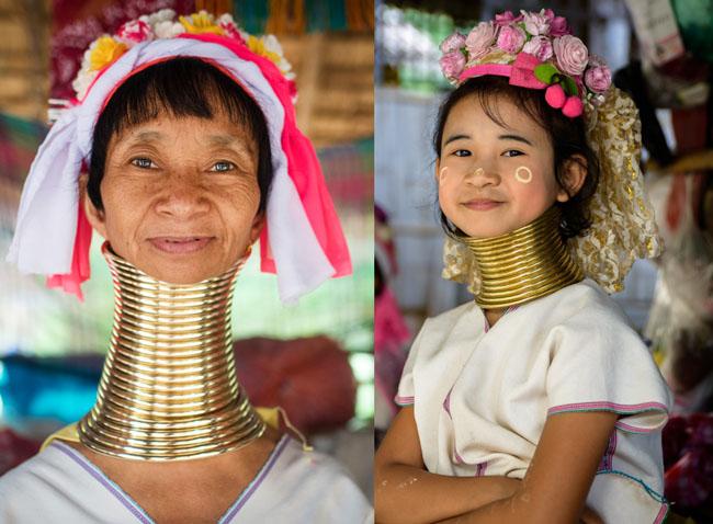 bo chan got sen, keo co dai: lam dep ky quai, dau don the nay ma van co nguoi lam! - 6