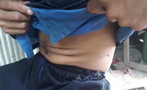 xot xa canh nong dan ngheo mien tay nham mat di ban than: phan ngheo lai gap eo! - 2