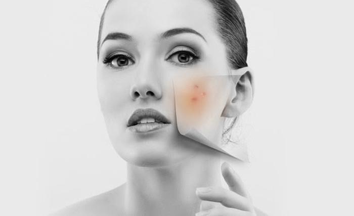 khong khi lanh tran ve, chi em nao bao "khong can boi kem chong nang" thi nham to roi! - 5