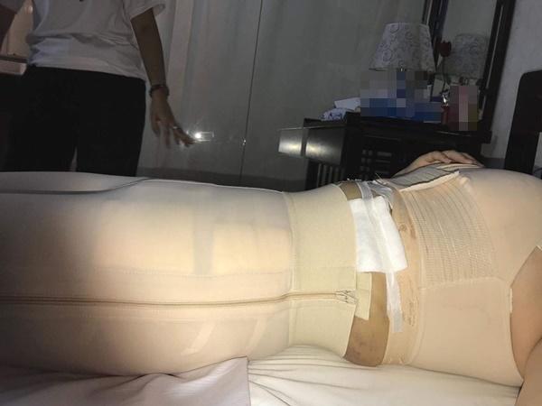 sau khi thu nho vong 1, nu sinh hai duong lai... hut 6l mo de co ve ngoai nhu y - 4