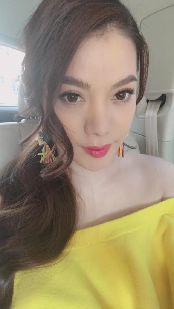 cam dai ngoang, mat cung do, phai chang truong ngoc anh gap bien chung khi phau thuat tham my? - 12