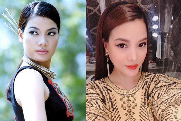 cam dai ngoang, mat cung do, phai chang truong ngoc anh gap bien chung khi phau thuat tham my? - 5