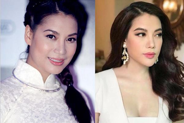 cam dai ngoang, mat cung do, phai chang truong ngoc anh gap bien chung khi phau thuat tham my? - 6