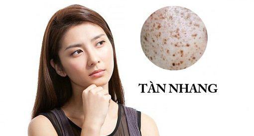 tri tan nhang hieu qua ngay tai nha voi 7 nguyen lieu chua den 10.000 dong! - 1