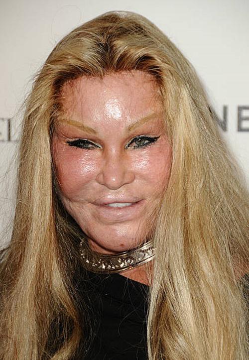 Jocelyn Wildenstein Nữ Tý Phú Trở Thành Thảm Họa Thẩm Mỹ Vì Chiều Chồng