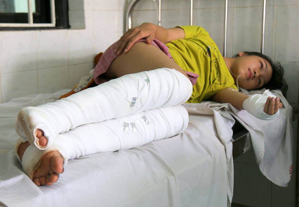 niu keo khong thanh, nguoi dan ong tuoi xang vao nguoi tinh roi om nhau tu thieu - 2
